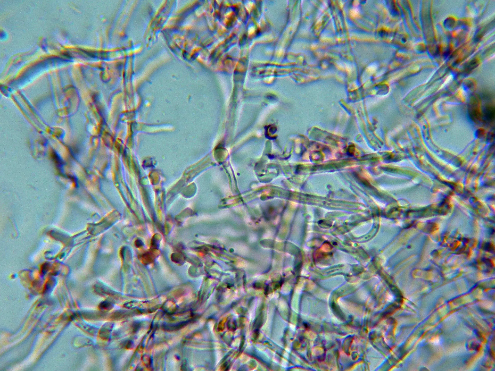 Microscopía de Skeletocutis carneogrisea - 11 - Hifas subiculares-003